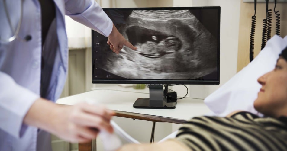 Arzt zeigt per Ultraschall die Lage des Babys im Bauch einer schwangeren Frau.